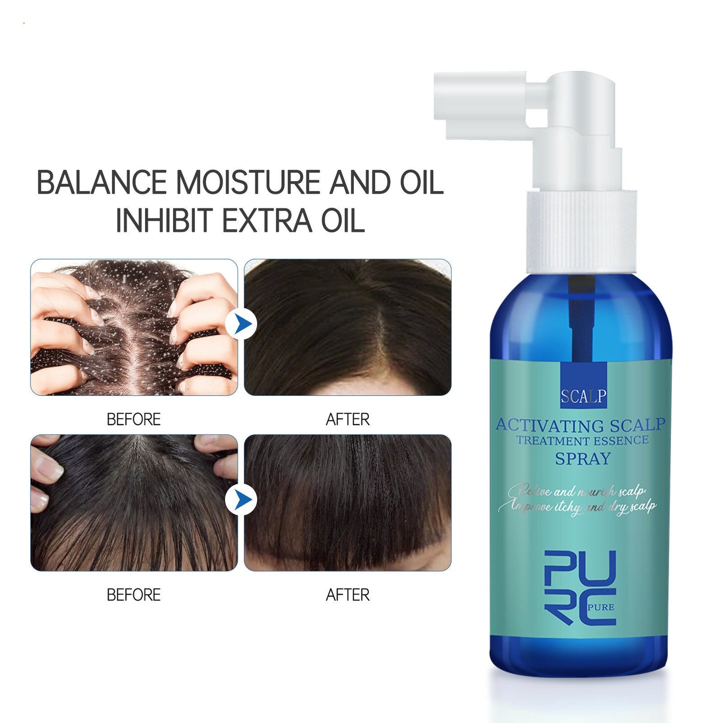 PURC Anti-Dandruff Hair Oil